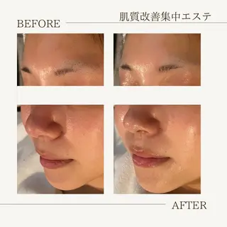 肌育成サロン ♡ RISAのエステ・リラクイメージ