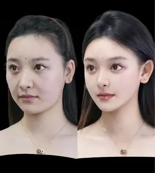 マツエク・マツパ aliaハイフ&水光ジェットサロン所属・aliaハーブ水光店 エステティシャン募集のエステ・リラクイメージ