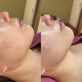 脱毛和みサロン新茶屋所属・脱毛和みサロン新茶屋 ひろみ（女性専用）のエステ・リラクイメージ