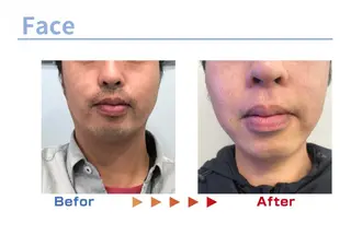 メンズ セルフ脱毛/美尻イス キングスサロン熊本のエステ・リラクイメージ