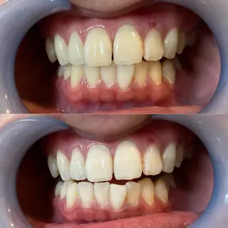 LBSホワイトニング 新宿店💝店長熊倉のエステ・リラクイメージ