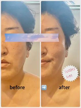 フェイシャルサロン ビアンカガーデンのエステ・リラクイメージ