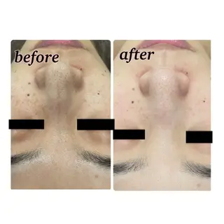 【folche】 フジイのエステ・リラクイメージ