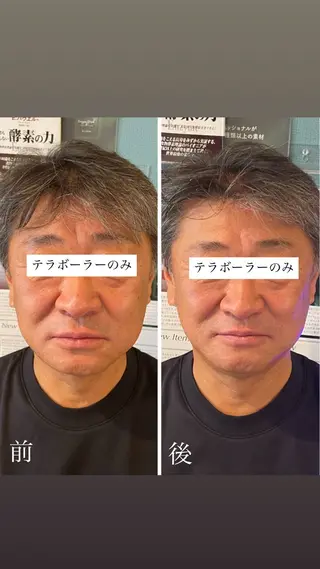 耳ツボ/体質改善/ 温活La mer月島のその他イメージ