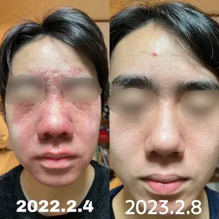 private salon  Dea_maris シュガーリング＆パーソナルボディケア所属・シミ改善・韓国肌管理 ボディメイク痩身のその他イメージ