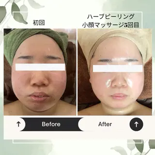 バスト美肌小顔専門 Mimpi【ミンピ】のエステ・リラクイメージ