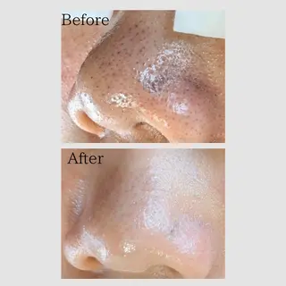 リメンテ所属・韓国肌管理Mote 新宿店のエステ・リラクイメージ