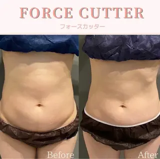 Hu.ruana AWANOのエステ・リラクイメージ