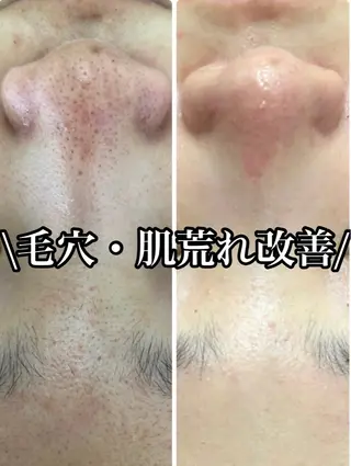 LILIANA所属・LILIANA ☆YURIのエステ・リラクイメージ