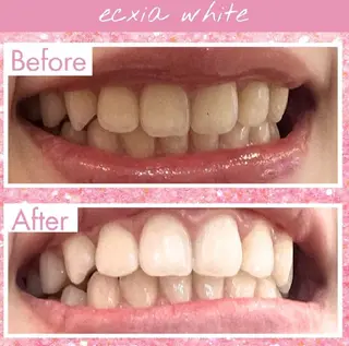 セルフホワイトニングサロンエクシアホワイト倉敷店所属・ecxiawhite 倉敷店のエステ・リラクイメージ