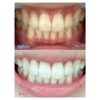 M渋谷店所属・Ｍ渋谷 ホワイトニングのエステ・リラクイメージ