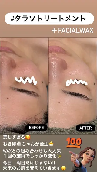 LiZA エステティックサロンのエステ・リラクイメージ