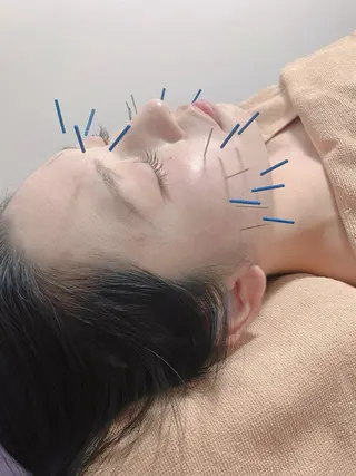 美容鍼/鍼灸 ここみ鍼灸院のエステ・リラクイメージ