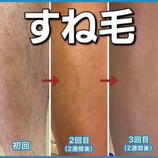 メンズ 脱毛サロン　K’9所属・脱毛&Beauty  K'9のエステ・リラクイメージ