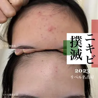 パーマ マツエク・マツパ 次世代まつげパーマは 『リベル名古屋』のマツエク・マツパデザイン