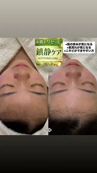 aroma  YURARI所属・韓国艶美人// 毛穴ケア🌹のエステ・リラクイメージ