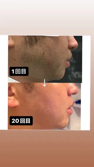 メンズ メンズ脱毛サロン kurozukinのエステ・リラクイメージ