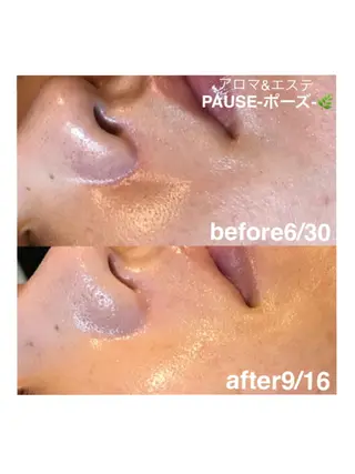 浜野 恵美のエステ・リラクイメージ