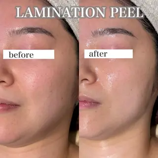 beautysalon RAVIS所属・東大阪/韓国肌管理/ 痩身バスト専門店のエステ・リラクイメージ