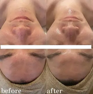 中目黒ハーブピーリン グ🌿ララピールのエステ・リラクイメージ