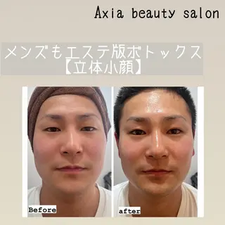アクシア ビューティー サロン所属・究極のアンチエイ ジングサロンのエステ・リラクイメージ