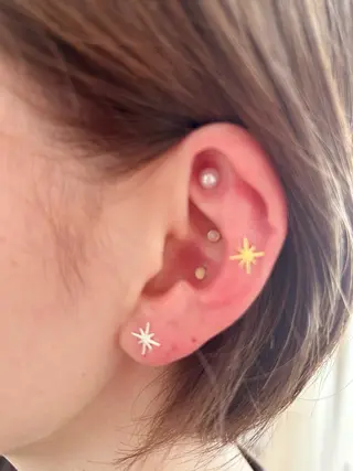 宮代・脱毛サロンMIIN所属・地域最安値の脱毛と 韓国美容【MIIN】のエステ・リラクイメージ