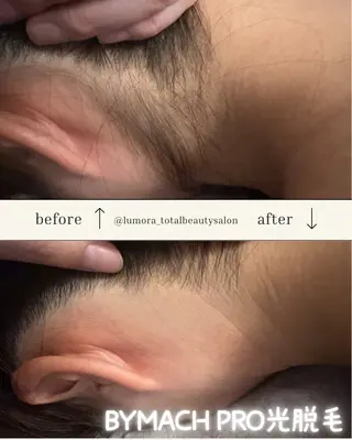 TOTAL BEAUTYSALON LUMORA所属・💫LUMORA💫 トータルビューティーのエステ・リラクイメージ