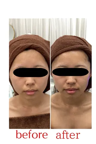 山村 しおんのエステ・リラクイメージ