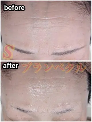 エステサロン　Sブランペタル所属・三沢市エステサロン Sブランペタルのエステ・リラクイメージ