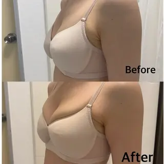 エクラパピヨン バストアップサロンのエステ・リラクイメージ