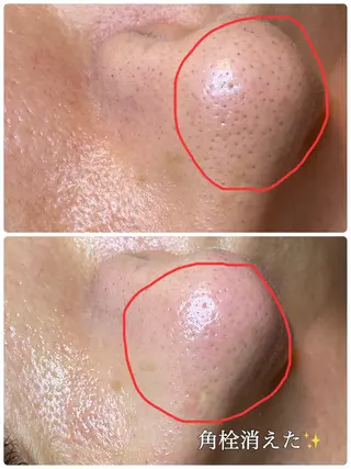 多摩境Beauty Salon  ViVi所属・多摩境ViVi chinamiのエステ・リラクイメージ