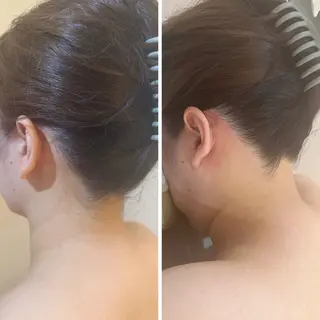 うなじ脱毛/美肌脱毛 LABELのエステ・リラクイメージ