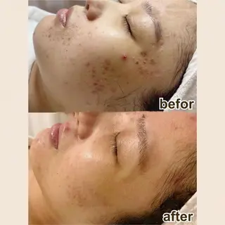 LingK/Este 駒田 辰玲のエステ・リラクイメージ