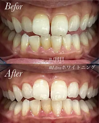 Libra所属・Libra 脱毛/ホワイトニングのその他イメージ