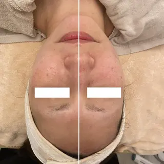 ララ/ハーブ メゾンリュバンのエステ・リラクイメージ