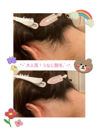 メンズ 都度払い脱毛⭐️ 脱毛サロンMIRACのエステ・リラクイメージ