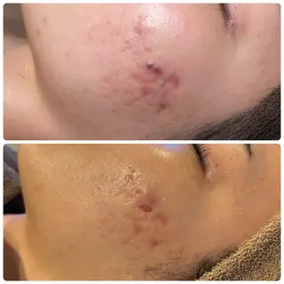 Cocofran/ manatsuのエステ・リラクイメージ