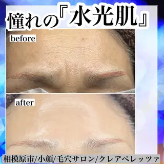 毛穴/肌質改善サロン クレアベレッツァのエステ・リラクイメージ