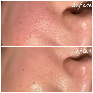 メンズ メナード岐阜市茜部 杉浦のエステ・リラクイメージ