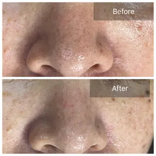 肌質改善サロン facialmoonのエステ・リラクイメージ