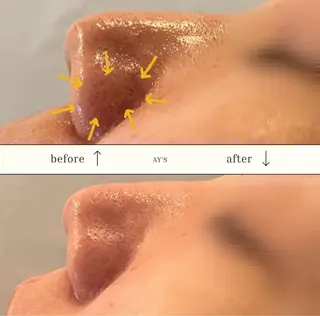 AY'S所属・倉敷/玉島/毛穴洗浄 古川碧のエステ・リラクイメージ