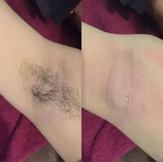 MIX脱毛サロン・リュミエールアンジュ所属・MIX脱毛 リュミエールアンジュのエステ・リラクイメージ