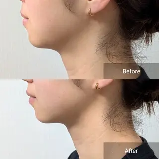 nail RiRi アトレナチュラのエステ・リラクイメージ