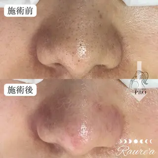 Raure'a Yurikoのエステ・リラクイメージ