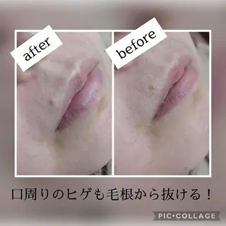 Lutella所属・ワックス脱毛専門店 Lutellaのエステ・リラクイメージ