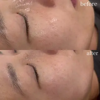 Re.Grace所属・Re.Grace片野 由茉のエステ・リラクイメージ