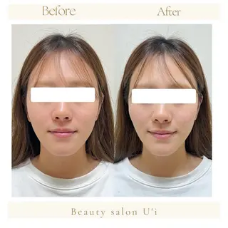 頭蓋骨小顔矯正 藤本のエステ・リラクイメージ