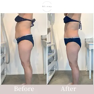 綺麗のひみつ グランプリ受賞店のエステ・リラクイメージ