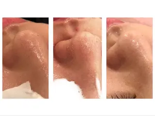 痛くない美肌脱毛 AZALEA本厚木店のエステ・リラクイメージ