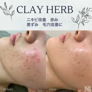 美肌&アロマ🌸 nana 中目黒のエステ・リラクイメージ